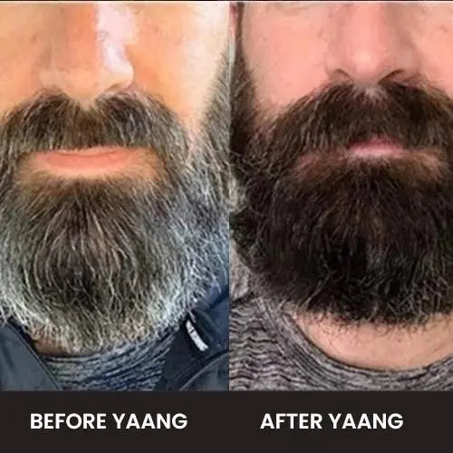 Anti Grey Beard SerumOil - ekartz99